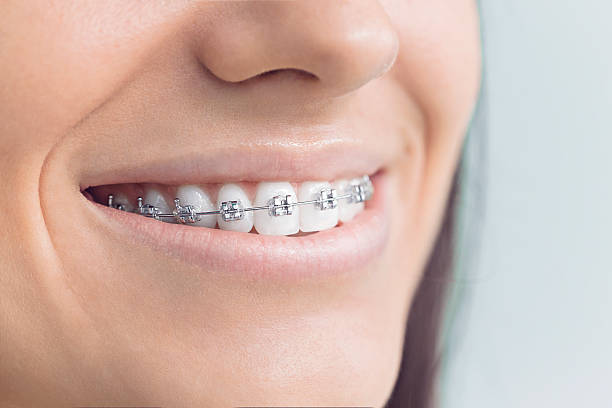 Best Dentures (Full and Partial)  in Spring Valley, NV